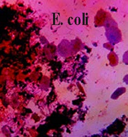 ecoli.jpg